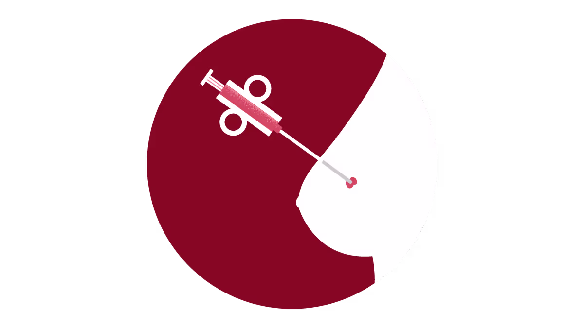 Core needle biopsy breast cancer testing